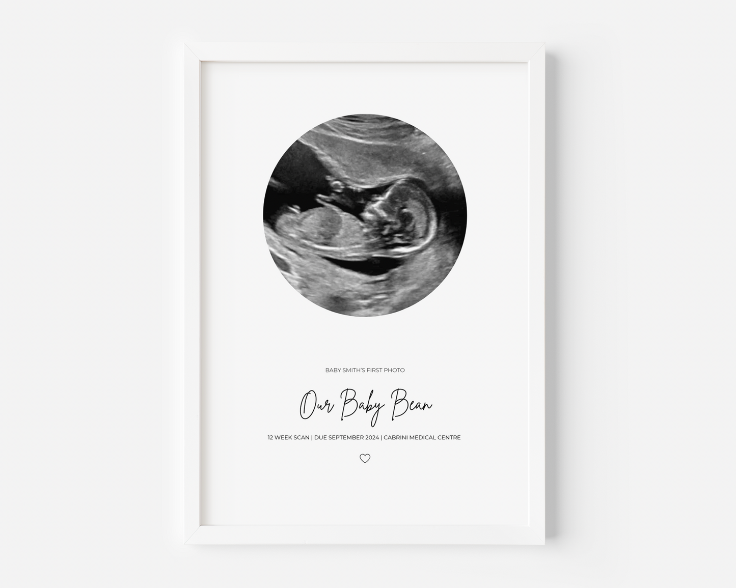 Ultrasound Personalised Print