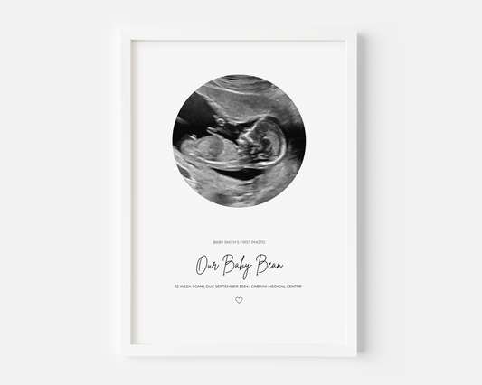 Ultrasound Personalised Print